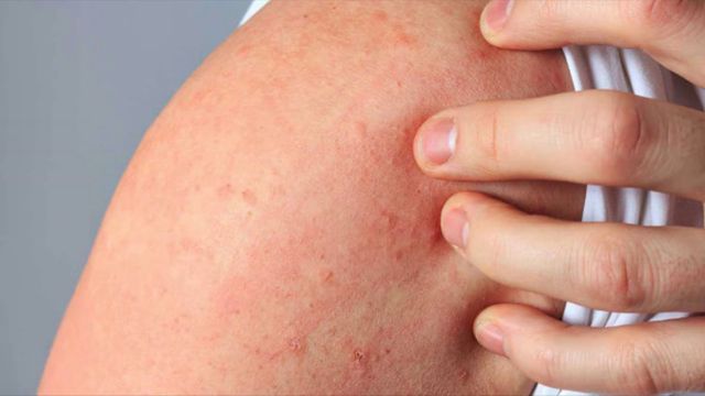 O significado da comichão na linguagem do teu corpo